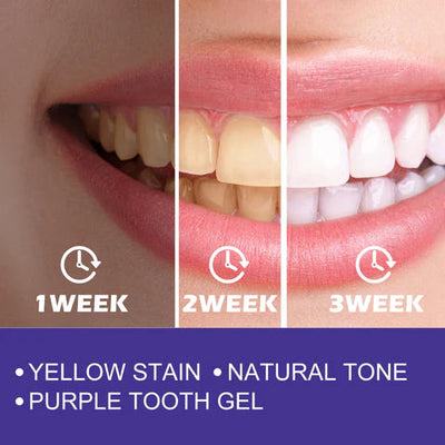 EELHOE PURPLE WHITENING TOOTHPASTE STAIN REMOVAL